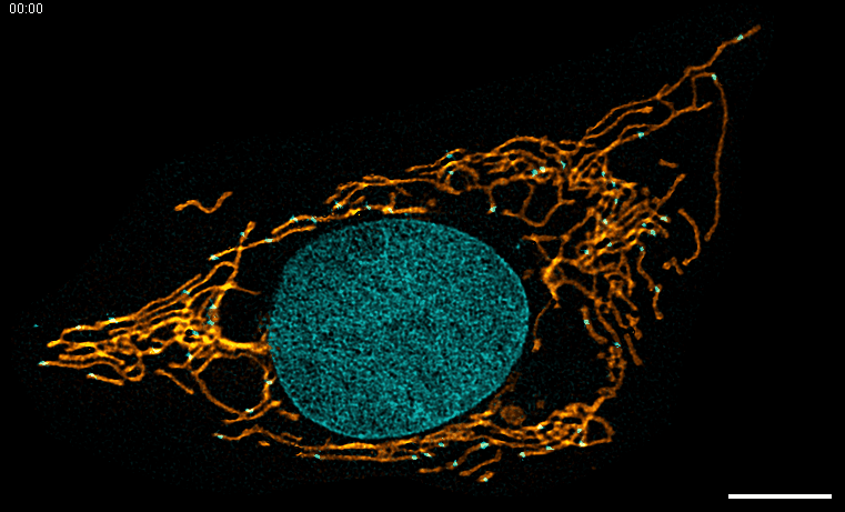 Mitochondria and nucleic acid of the Antarctic spiny plunderfish. Mitochondria and nucleic acid of the Antarctic spiny plunderfish.